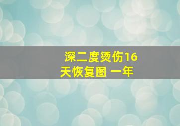 深二度烫伤16天恢复图 一年